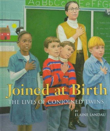 Joined At Birth: the lives of conjoined twins